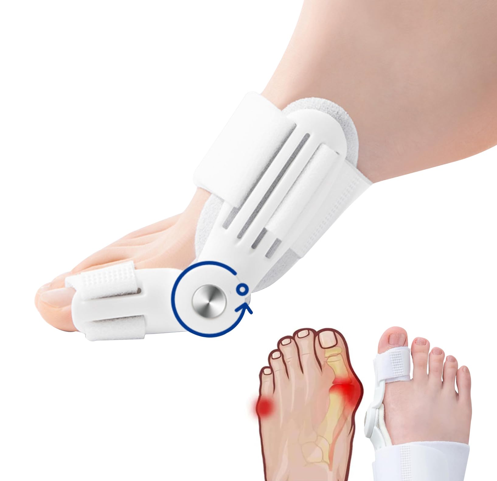 足指サポーター 外反母趾専用パッド簡単着脱 左右兼用 (1足組)ホワイト Amazon | FTBOL 外反母趾 サポーター 寝る時 足指 広げる 寝る時